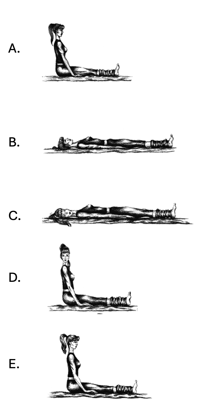 Figure: Vannucchi-Asprella maneuver for treating left-sided lateral canal BPPV. Adapted from Vannucchi et al. (Vannucchi et al. 2005)
