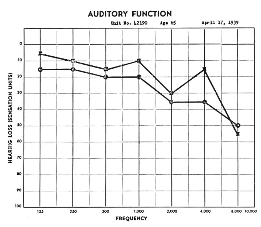 Audiogram from the first patient in the series reported by Lindsay and Hemenway (Hemenway and Lindsay 1956), showing that pure tone hearing was 5 – 20 dB weaker on the right (the side with vestibular weakness and benign paroxysmal positional vertigo) than on the left at 125 Hz – 4 kHz.